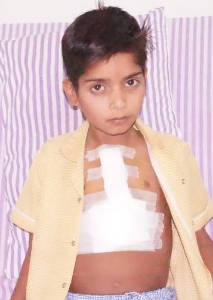  बाडमेर के बच्चे के दिल मे छेद का निःशुल्क ऑपरेशन