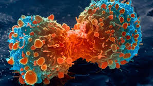 OMG:हर रोज 1300 लोग हो रहे कैंसर के शिकार : अश्विनी