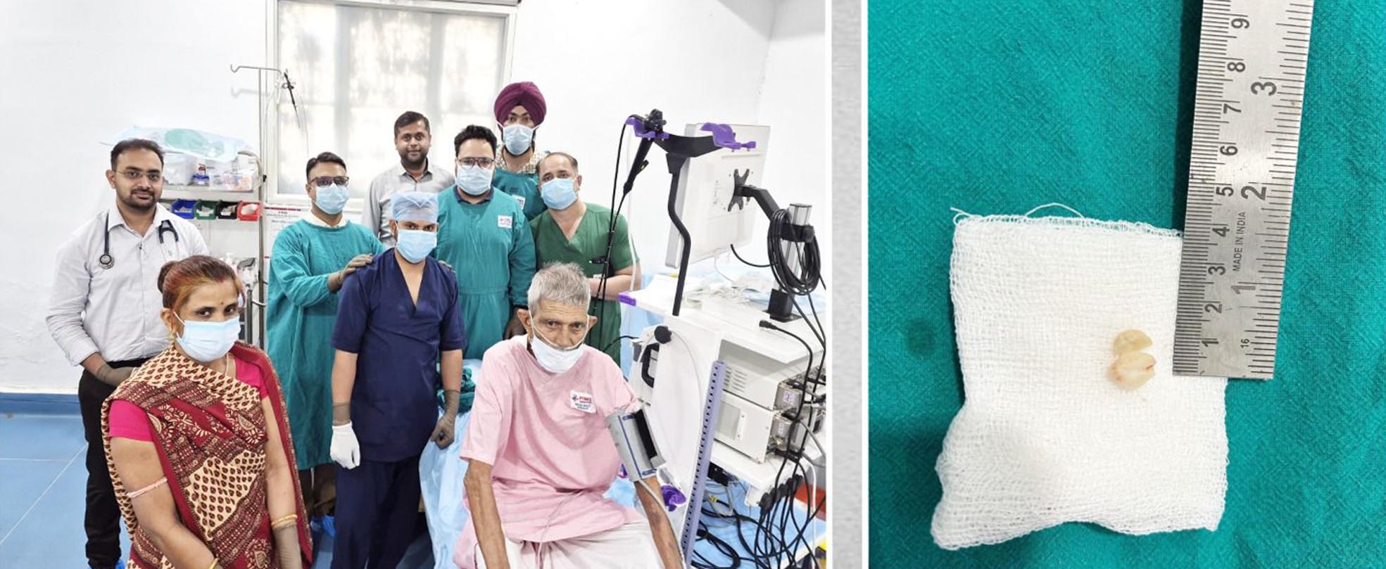 Successful Removal of Foreign Body Resolves Rare Lung Infection Case at PIMS Hospital Udaipur