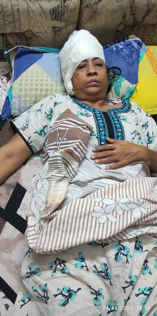 मॉर्निंग वॉक पर गई महिला को कुत्तों ने बूरी तरह किया जख्मी,महिला के कई आए टांके